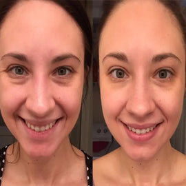 Clear the confusion and your skin with Serum and Oils